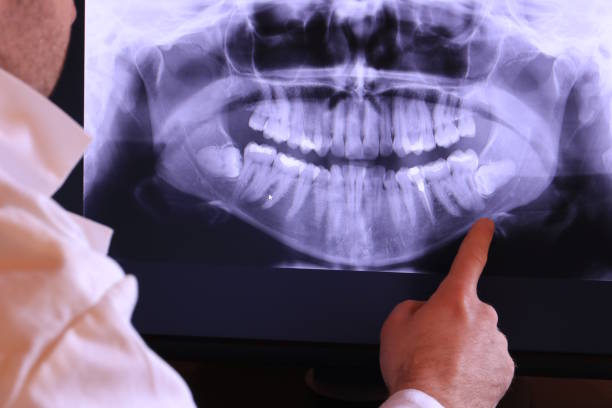 Best Emergency Denture Repair in Chester Center, CT
